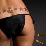 exercises to reduce the saddlebags around your thighs and hips