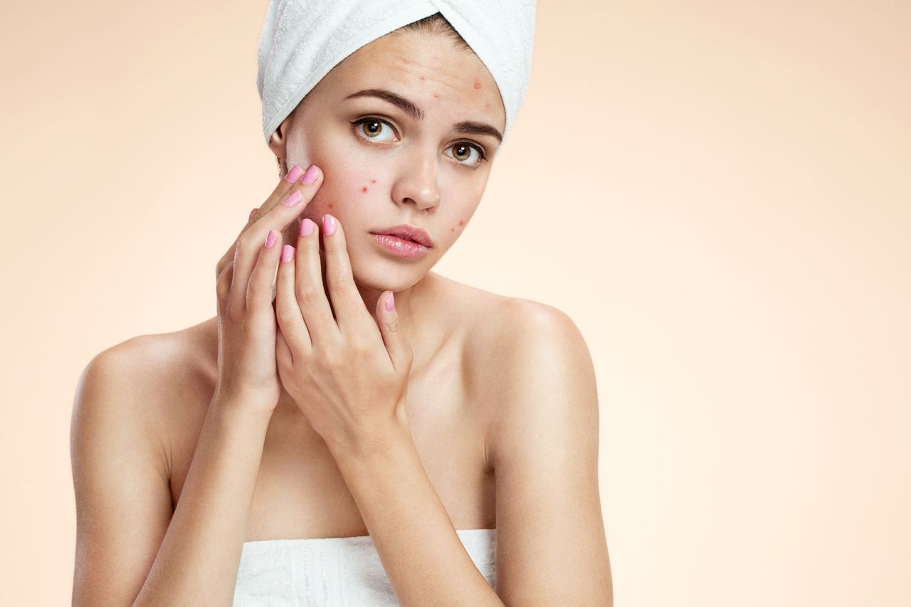 Acne Types Causes Treatment And Prevention Tips