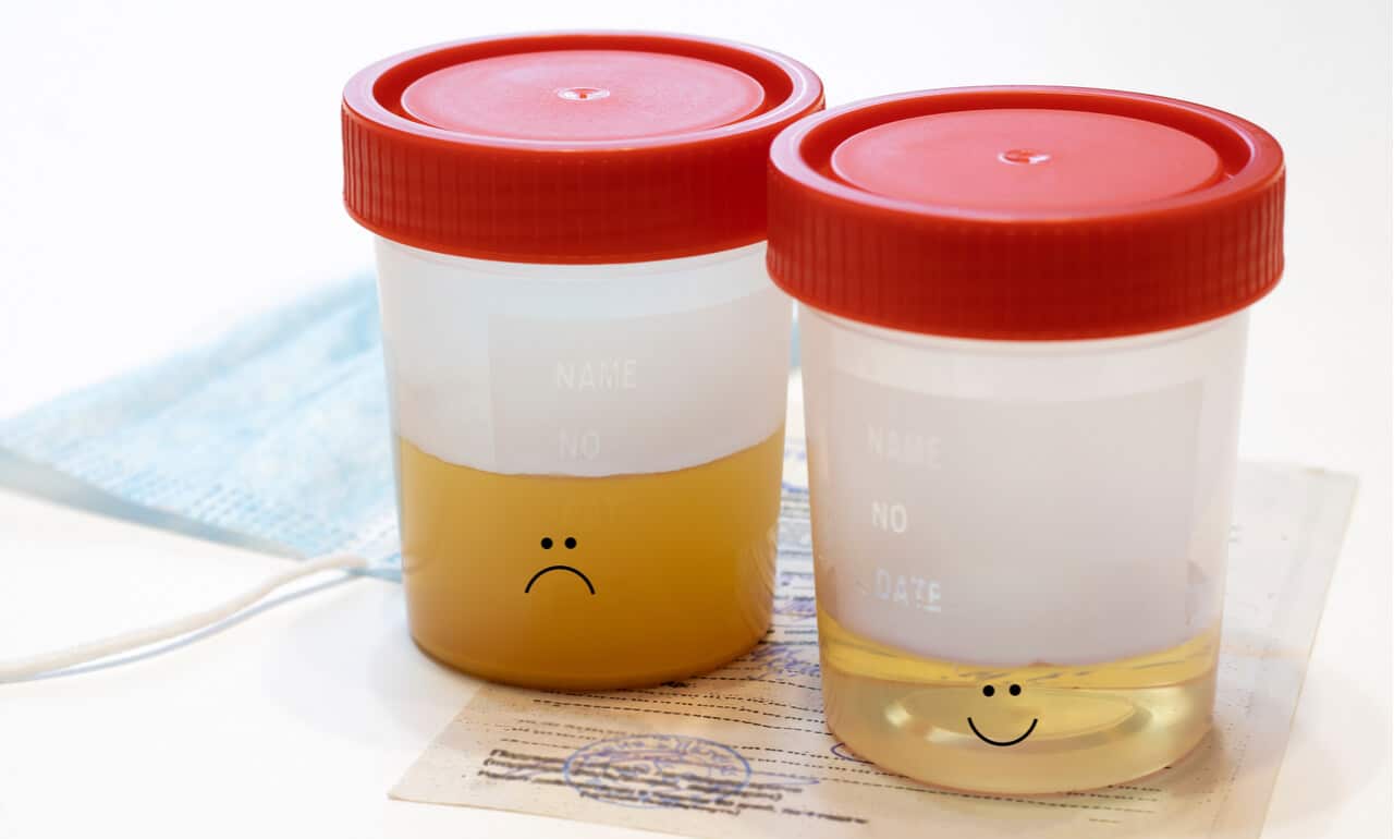 Everything You Should Know About Cloudy Urine HealthifyMe